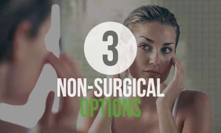 3 non surgical options flyer