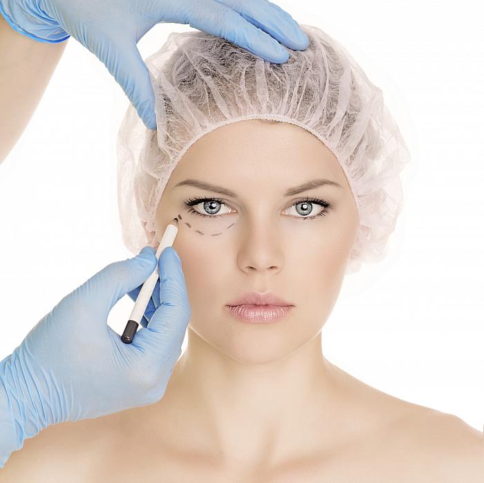 young woman's face marked for facial treatment with dotted lines under the eyes