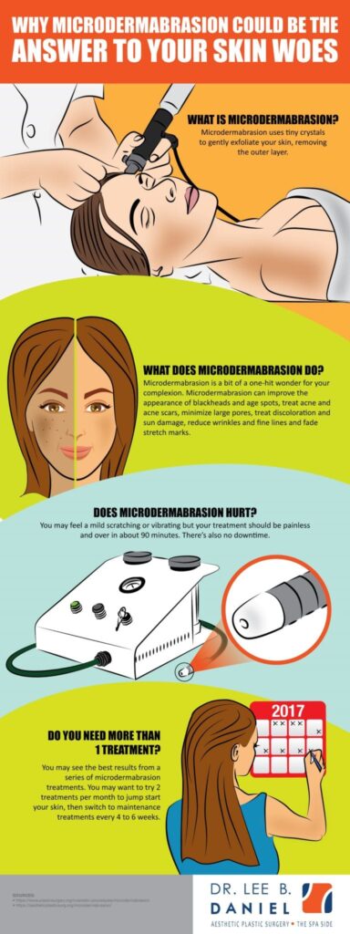 Microdermabr infographic