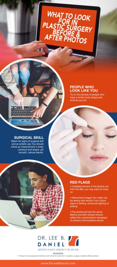 Infograph about What to look for in plastic surgery