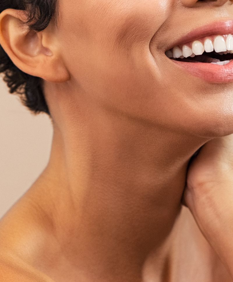 women smiling after MOXI™ laser treatment